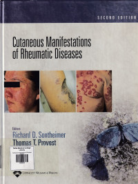 Image of Cutaneous manifestations of rheumatic diseases