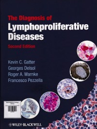 Image of Diagnosis of lymphoproliferative diseases