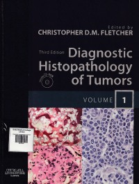 Image of Diagnostic histopathology of tumors.vol.01