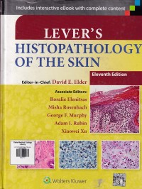 Image of Lever's histopathology of the skin