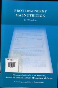 Image of Protein-energy malnutrition